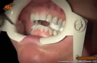اموزش پزشکی: ارتودنسی دندان