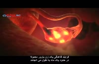 دکتر فریده عرب جهوانی درمان نازایی به شیوه IVF می گوید .