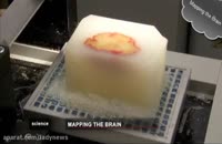 نقشه برداری سه بعدی مغز