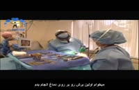دکتر مسعود بنیاد ی و آخرین پیشرفت ها در جراحی پلاستیک - سلامت